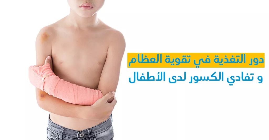 دور التّغذية في تقوية العظام و تفادي الكسور لدى الأطفال